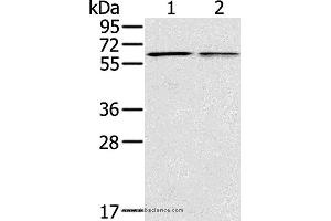 Western blot analysis of Mouse liver and lung tissue, using PTGER2 Polyclonal Antibody at dilution of 1:200 (PTGER2 Antikörper)