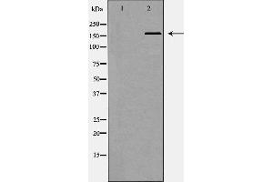 Western blot analysis of Hepg2 whole cell lysates, using SMARCA4 Antibody. (SMARCA4 Antikörper  (N-Term))