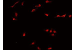 ABIN6269035 staining MCF-7 cells by IF/ICC. (DNMT3B Antikörper  (N-Term))