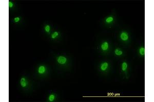Immunofluorescence of monoclonal antibody to SMAD2 on HeLa cell.
