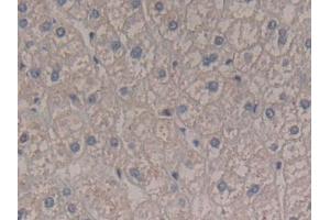 DAB staining on IHC-P; Samples: Human Liver Tissue (Interferon gamma Antikörper  (AA 24-166))