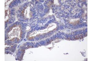 Image no. 1 for anti-Cytochrome P450, Family 2, Subfamily J, Polypeptide 2 (CYP2J2) antibody (ABIN1497733) (CYP2J2 Antikörper)