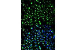 Immunofluorescence analysis of HeLa cells using PHB antibody. (Prohibitin Antikörper  (AA 73-272))
