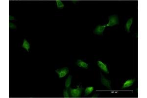 Immunofluorescence of monoclonal antibody to IL1A on HeLa cell. (IL1A Antikörper  (AA 172-271))