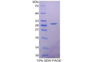 SDS-PAGE (SDS) image for Surfactant Protein A1 (SFTPA1) (AA 21-248) protein (His tag) (ABIN2126881)