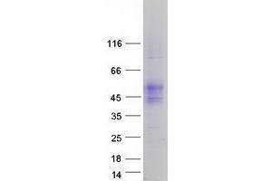 Western Blotting (WB) image for Transmembrane and Immunoglobulin Domain Containing 2 (TMIGD2) (Transcript Variant 2) protein (Myc-DYKDDDDK Tag) (ABIN2733920)