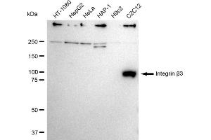 Western blotting analysis using Integrin β3 antibody (ABIN7799070).
