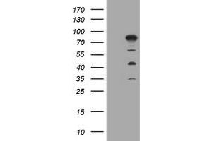 Image no. 1 for anti-Myotubularin Related Protein 2 (MTMR2) antibody (ABIN1499592) (MTMR2 Antikörper)