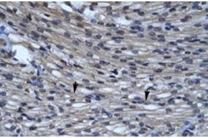 Immunohistochemical staining (Formalin-fixed paraffin-embedded sections) of human heart with CLIC5 polyclonal antibody  at 4-8 ug/mL working concentration. (CLIC5 Antikörper  (C-Term))