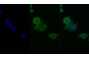 Detection of PAI1 in Human Hela cell using Monoclonal Antibody to Plasminogen Activator Inhibitor 1 (PAI1) (PAI1 Antikörper)