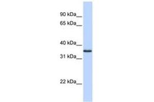 Image no. 1 for anti-COP9 Constitutive Photomorphogenic Homolog Subunit 5 (Arabidopsis) (COPS5) (N-Term) antibody (ABIN6742215) (COPS5 Antikörper  (N-Term))