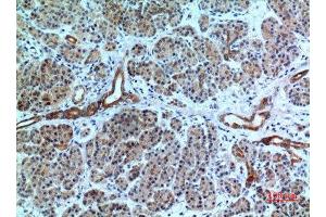 Immunohistochemistry (IHC) analysis of paraffin-embedded Human Pancreas, antibody was diluted at 1:100. (CXCR6 Antikörper  (N-Term))