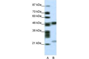 Western Blotting (WB) image for anti-PHD Finger Protein 11 (PHF11) antibody (ABIN2461063) (PHF11 Antikörper)