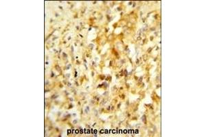 Immunohistochemistry (Paraffin-embedded Sections) (IHC (p)) image for anti-NK3 Homeobox 1 (NKX3-1) (AA 118-145) antibody (ABIN652945)