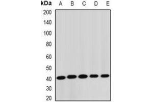 Western blot analysis of STK19 expression in Jurkat (A), HepG2 (B), mouse liver (C), rat lung (D), rat brain (E) whole cell lysates. (STK19 Antikörper)