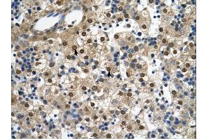 SQLE antibody was used for immunohistochemistry at a concentration of 4-8 ug/ml.