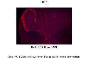 Sample Type :  Mouse spinal cord  Primary Antibody Dilution :  1:300  Secondary Antibody :  Anti-rabbit-Alexa 594  Secondary Antibody Dilution :  1:500  Color/Signal Descriptions :  Red: DCX Blue:DAPI  Gene Name :  DCX  Submitted by :  Anonymous (Doublecortin Antikörper  (C-Term))