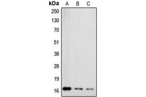 Western blot analysis of Gamma-synuclein expression in MCF7 (A), HT29 (B), HeLa (C) whole cell lysates. (SNCG Antikörper  (C-Term))