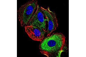 Immunofluorescence (IF) image for anti-Activating Transcription Factor 3 (ATF3) (AA 1-181) antibody (ABIN5542272)