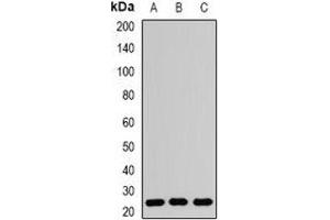 Western blot analysis of RAB5A expression in Hela (A), PC12 (B), mouse brain (C) whole cell lysates. (RAB5 Antikörper)