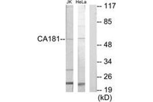 Western blot analysis of extracts from Jurkat/HeLa cells, using CA181 Antibody. (CA181 (AA 301-350) Antikörper)