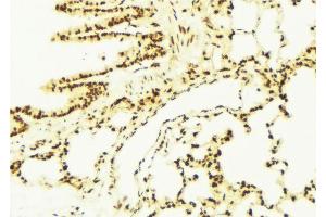 ABIN6273091 at 1/100 staining Mouse lung tissue by IHC-P. (ALDH7A1 Antikörper  (C-Term))