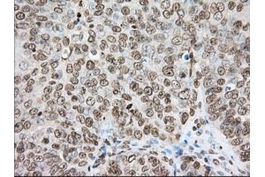 Immunohistochemical staining of paraffin-embedded Human colon tissue using anti-CYP1A2 mouse monoclonal antibody. (CYP1A2 Antikörper)
