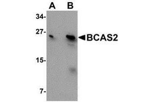 Western blot analysis of BCAS2 in MCF7 cell lysate with AP30126PU-N BCAS2 antibody at (A) 0. (BCAS2 Antikörper  (C-Term))