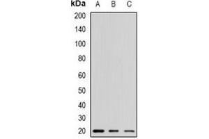 Western blot analysis of Alpha-crystallin A expression in mouse kidney (A), mouse liver (B), mouse heart (C) whole cell lysates. (CRYAA Antikörper)