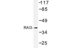 Image no. 1 for anti-G Protein-Coupled Receptor, Family C, Group 5, Member A (GPRC5A) antibody (ABIN317865) (GPRC5A Antikörper)