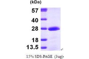 SDS-PAGE (SDS) image for Phosphomevalonate Kinase (PMVK) (AA 1-192) protein (His tag) (ABIN667225)