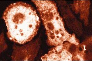 Immunofluorescence staining of mouse macrophages stimulated with 10 ng/mL IFNgamma and 1 µg/mL LPS. (NOS2 Antikörper  (AA 961-1144))