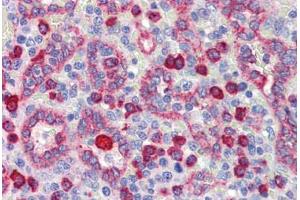 Immunohistochemistry (Paraffin-embedded Sections) (IHC (p)) image for anti-Nuclear Receptor Subfamily 2, Group C, Member 1 (NR2C1) (N-Term) antibody (ABIN6741570)