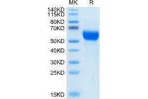 GFRA1 Protein (AA 25-424) (His tag)