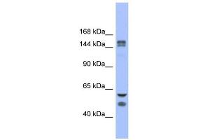 WB Suggested Anti-FBXL10 Antibody Titration: 0. (KDM2B Antikörper  (Middle Region))