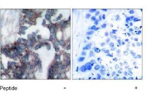 Image no. 1 for anti-Ribosomal Protein S6 Kinase, 70kDa, Polypeptide 1 (RPS6KB1) (Ser424) antibody (ABIN197548)
