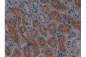 DAB staining on IHC-P; Samples: Rat Kidney Tissue (CUBN Antikörper  (AA 3511-3623))