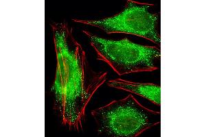 Fluorescent image of Hela cells stained with PPP2R2A Antibody (N-term). (PPP2R2A Antikörper  (N-Term))
