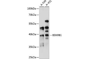 BDKRB1 antibody  (AA 1-100)