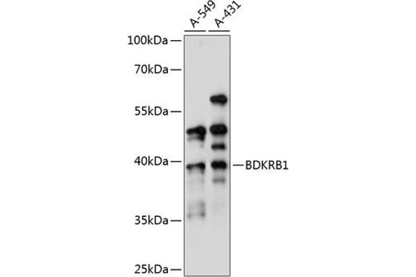 BDKRB1 antibody  (AA 1-100)