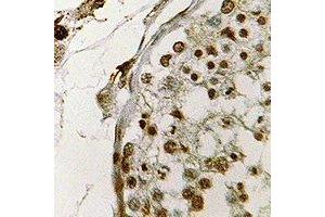 Immunohistochemical analysis of CIRBP staining in human testis formalin fixed paraffin embedded tissue section. (CIRBP Antikörper)
