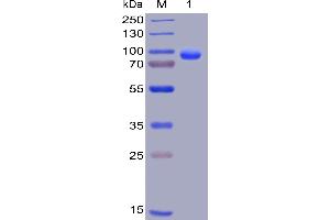 Human CD138, hFc-His Tag on SDS-PAGE under reducing condition. (Syndecan 1 Protein (SDC1) (AA 23-254) (Fc-His Tag))