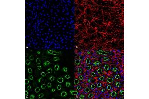 Immunohistochemistry analysis using Rabbit Anti-NKCC2 Polyclonal Antibody (ABIN2486317). (SLC12A1 Antikörper  (AA 33-55) (Atto 488))