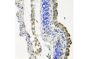 Immunohistochemistry of paraffin-embedded mouse lung using MARK1 antibody at dilution of 1:100 (x40 lens). (MARK1 Antikörper)