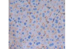 Used in DAB staining on fromalin fixed paraffin- embedded Kidney tissue (Signaling Lymphocytic Activation Molecule Family, Member 5 (AA 32-222) Antikörper)
