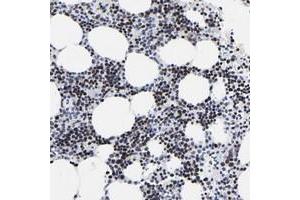 Immunohistochemical staining of human bone marrow with ZNF589 polyclonal antibody  shows strong nuclear positivity in bone marrow poietic cells. (ZNF589 Antikörper)