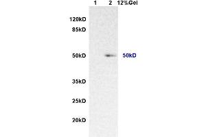 Lane 1: rat lung lysates Lane 2: human colon carcinomalysates probed with AntiIL-7Ra/CD127 Polyclonal Antibody, Unconjugated (ABIN731063) at 1:200 in 4 °C. (IL7R Antikörper  (AA 251-350))