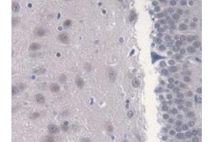 DAB staining on IHC-P; Samples: Rat Cerebrum Tissue (CAMLG Antikörper  (AA 1-188))