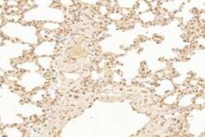Immunohistochemistry (Paraffin-embedded Sections) (IHC (p)) image for anti-TP53RK Binding Protein (TPRKB) antibody (ABIN7075943)
