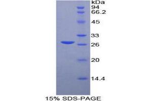 SDS-PAGE (SDS) image for Matrix Metalloproteinase 2 (MMP2) (AA 445-660) protein (His tag) (ABIN1080273)